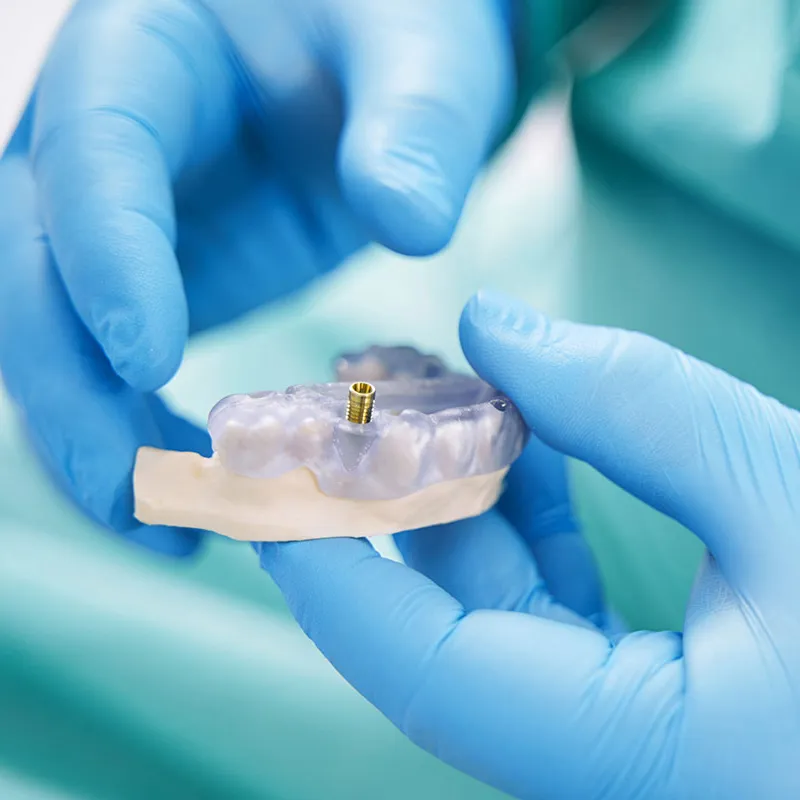 Antalya Dental Implants in Turkey