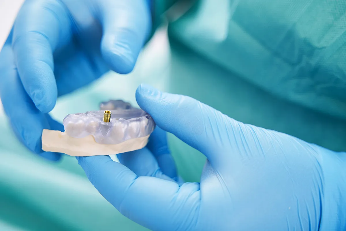 Dental Implant Surgery In Turkey