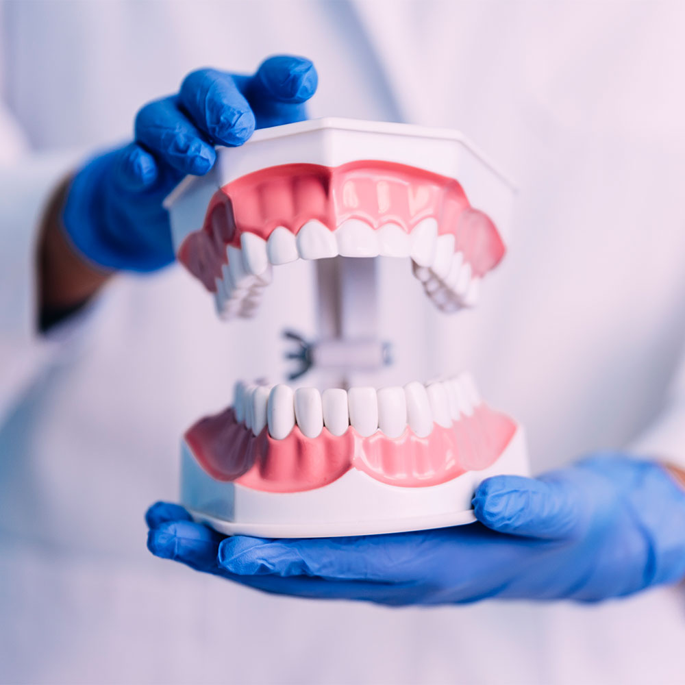 All on six dental implant 3d teeth