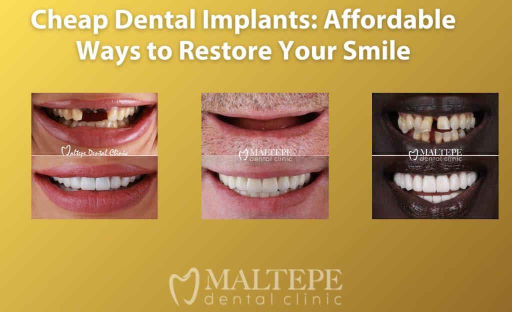 Practical Tips for Budgeting and Financing Your Dental Implant Journey