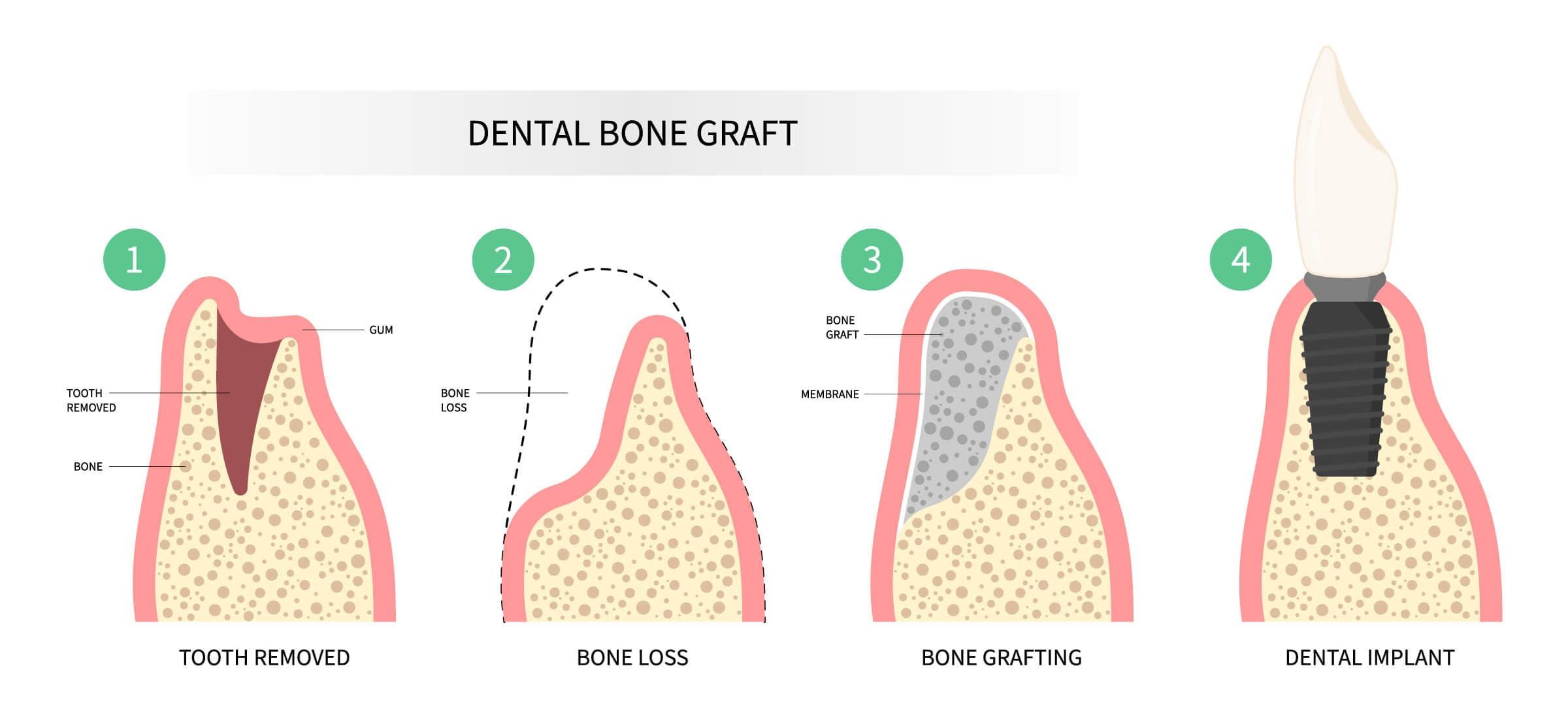 Understanding the Initial Healing Phase and Pain Management Strategies